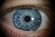 Augendiagnose